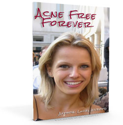acne-cover-small